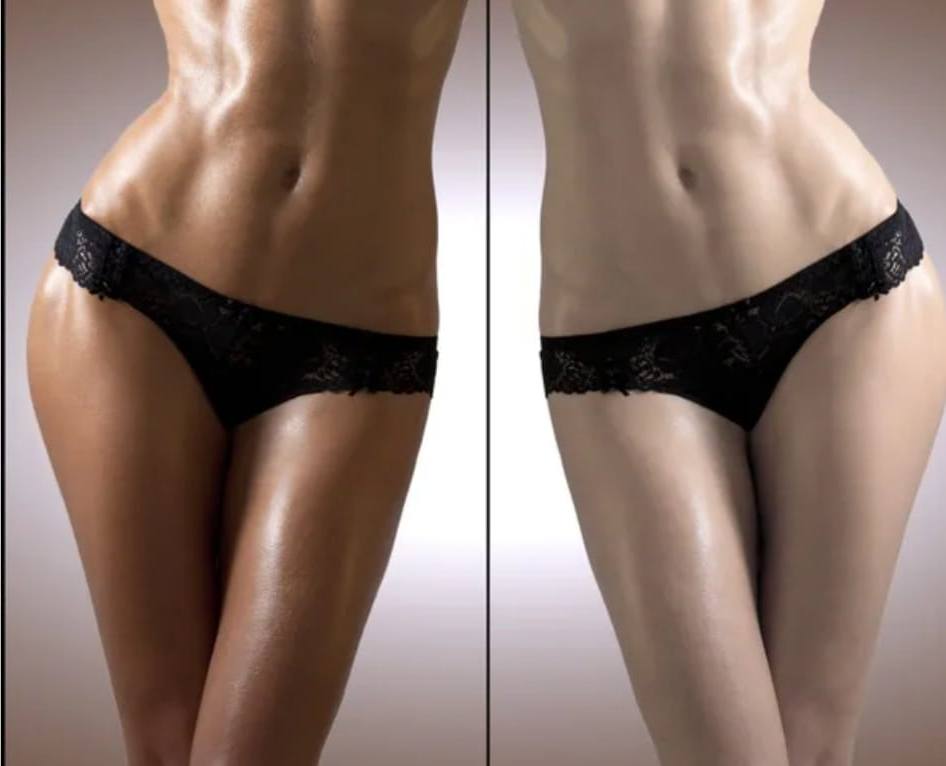 Body before and after